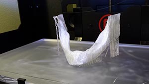 Model of Jaw bone printed in 3D using 3D printer at Periodontal Surgical Arts.