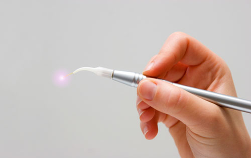 A hand holding a laser at Periodontal Surgical Arts in Austin, TX